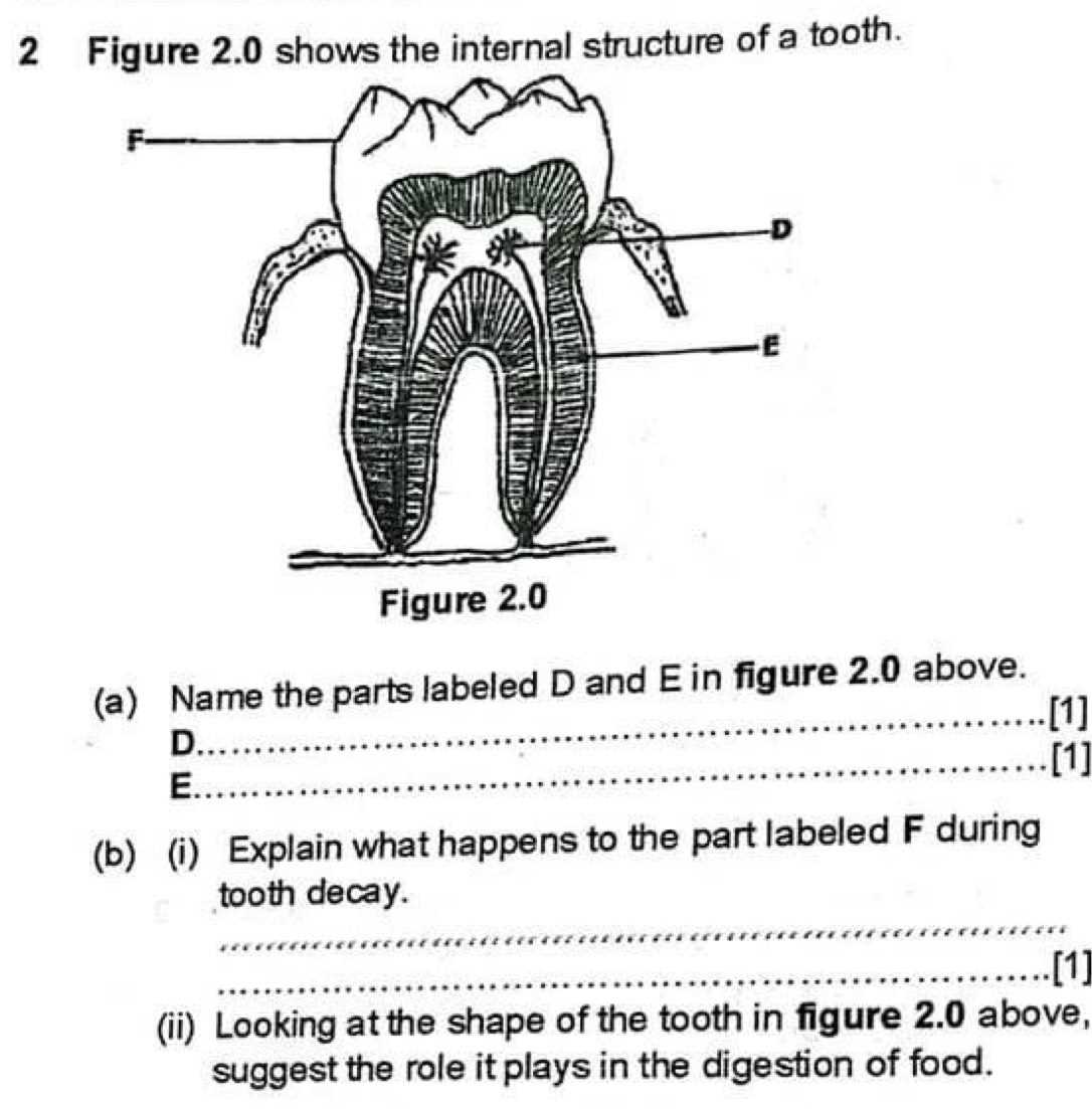 label parts of a tooth worksheet